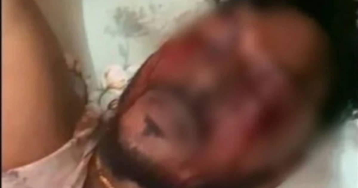 সন্ত্রাসীকে মারধরের পর দুই চোখ নষ্ট করার অভিযোগ