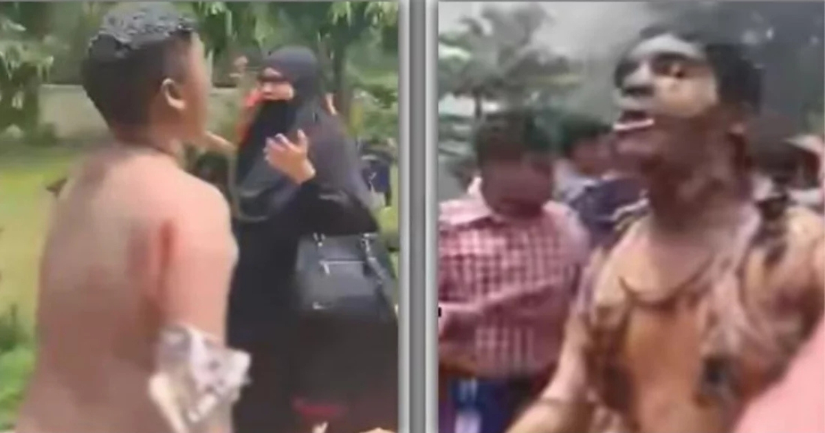 বিমান বিধ্বস্তের ঘটনায় পোড়া শরীর নিয়ে বের হচ্ছে অনেকে