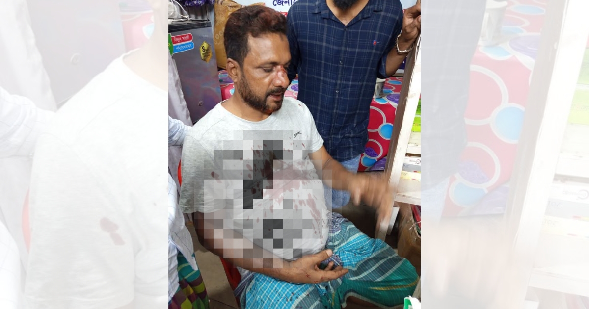 পূর্ব বিরোধের জেরে বিএনপি নেতাকে মারধর