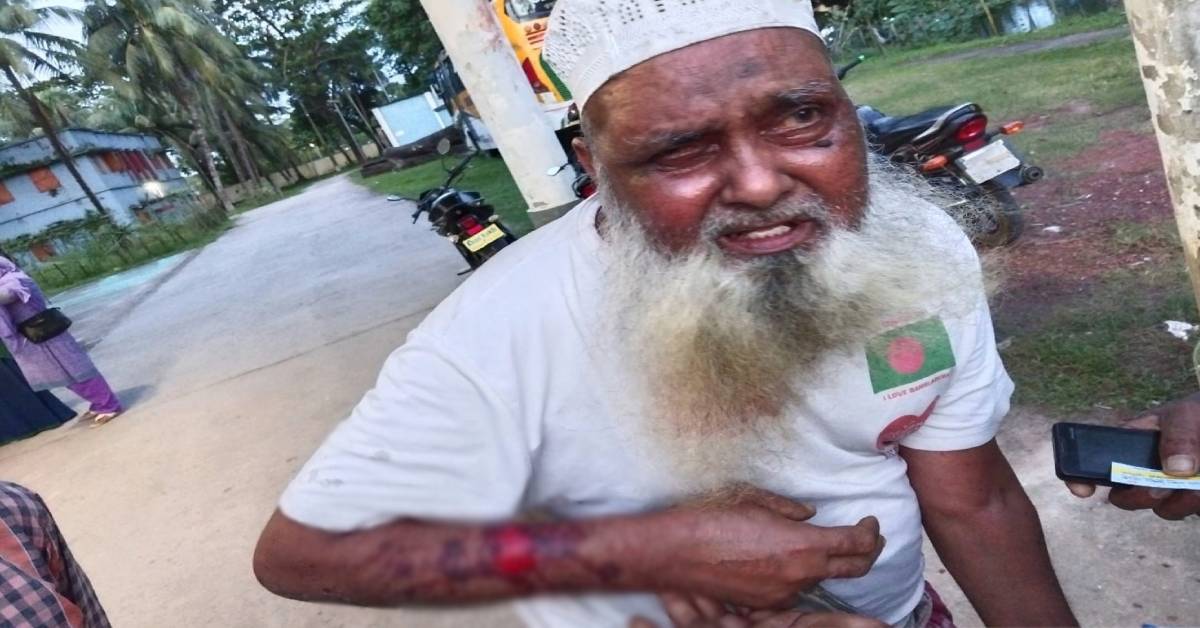 পুত্রবধু ও স্বজনদের নির্যাতনে আহত বৃদ্ধ শ্বশুর হাসপাতালে ভর্তি