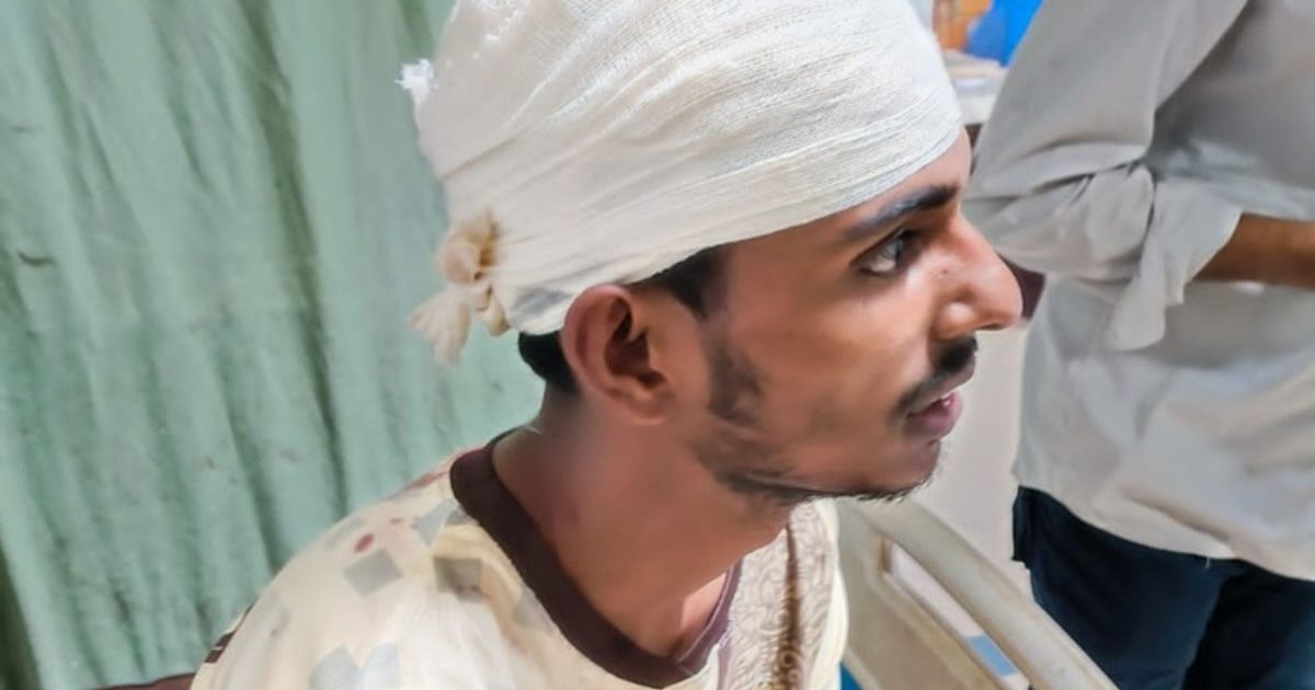 সিলেটে শিক্ষার্থীদের ওপর নিষিদ্ধ ছাত্রলীগের হামলা, আহত ১৪  