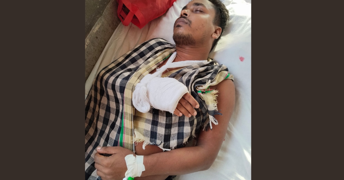 ইন্দুরকানীতে তুচ্ছ ঘটনাকে কেন্দ্র করে ছাত্রদল নেতার দুই হাত ভেঙে দিল প্রতিপক্ষরা