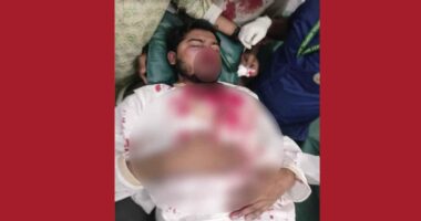 জাপা কার্যালয়ের সামনে সংঘর্ষ, গুরুতর আহত নুরুল হক নুর,আশঙ্কাজনক অবস্থা