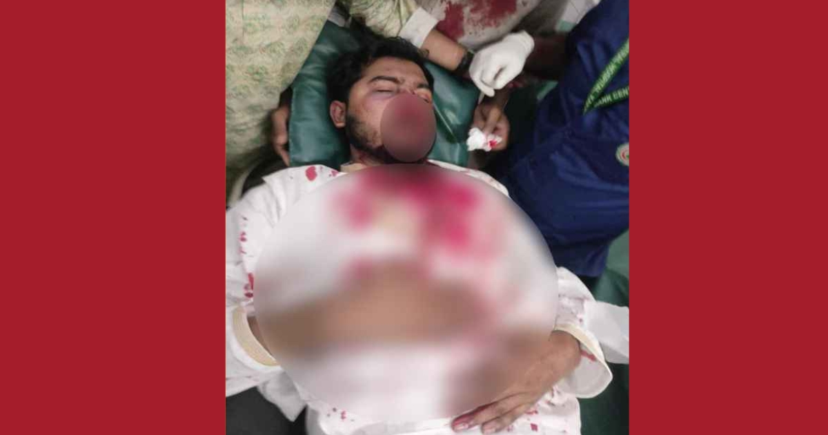 জাপা কার্যালয়ের সামনে সংঘর্ষ, গুরুতর আহত নুরুল হক নুর,আশঙ্কাজনক অবস্থা