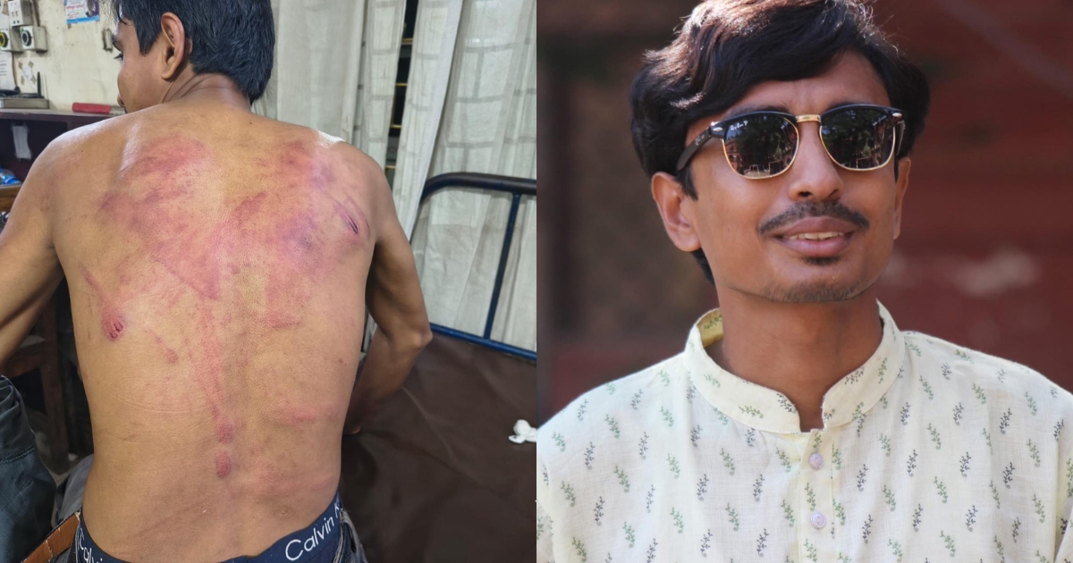 অতর্কিত হামলায় ছাত্র অধিকার পরিষদের নেতা গুরুতর আহত