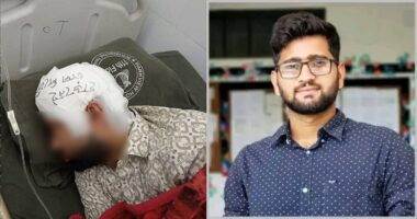 ফ্রিজে রাখা খুলি দুই মাস পর লাগানো হলো মামুনের মাথায়