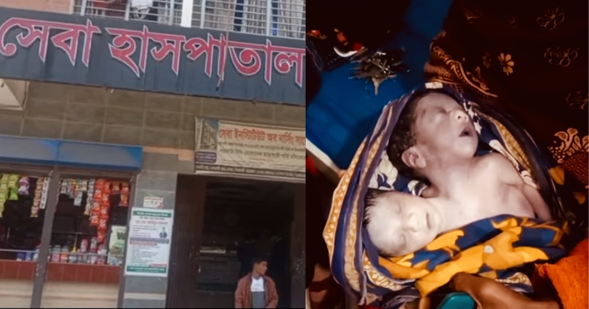  নীলফামারীর ডোমারে এক দেহে দুই মাথাবিশিষ্ট নবজাতকের জন্মর পরেই মৃত্যু