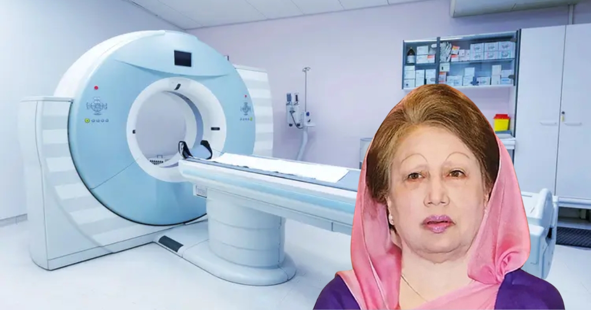 বেগম খালেদা জিয়ার সিটি স্ক্যান সম্পন্ন হয়েছে, রিপোর্ট স্বাভাবিক