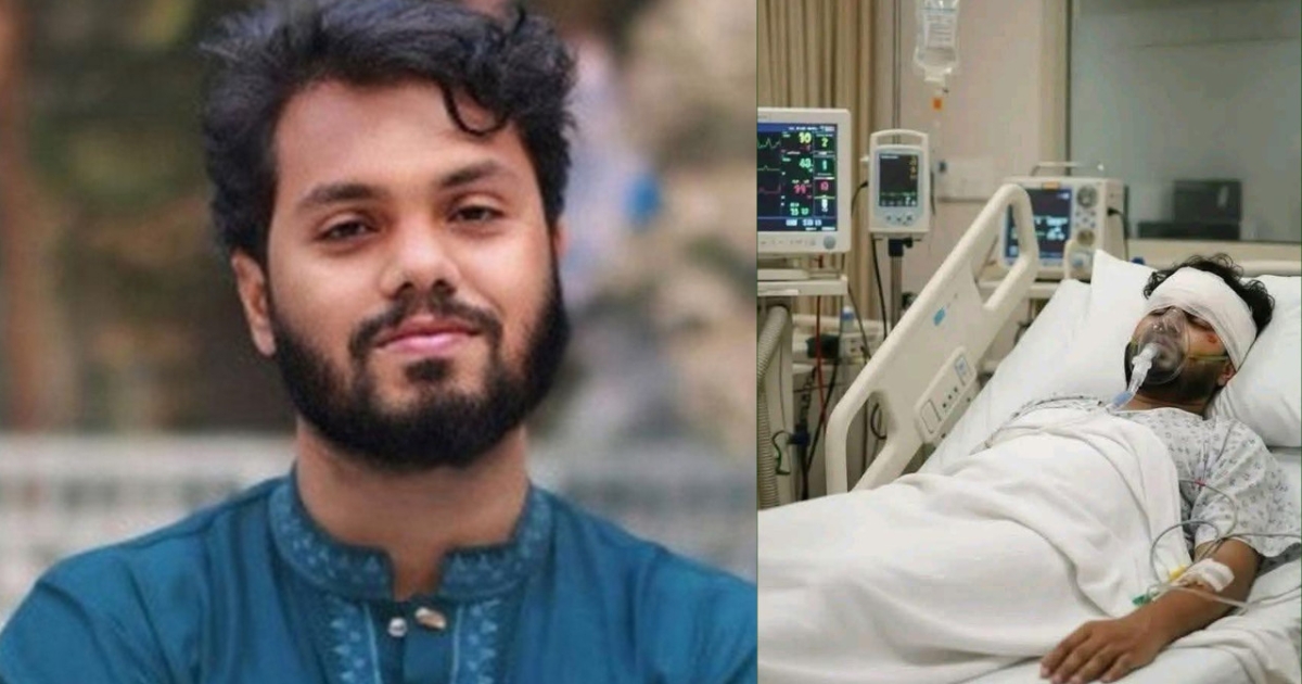 হাদির মস্তিষ্কে অক্সিজেন স্বল্পতা দেখা দিয়েছে, শারীরিক অবস্থা এখনো অত্যন্ত আশঙ্কাজনক