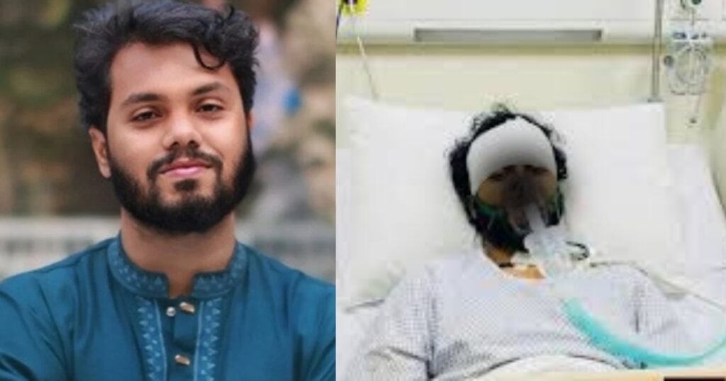 হাদির অবস্থার কিছুটা অবনতি হলেও ঝুঁকিমুক্ত, আরেকটি অপারেশন করার মতো শারীরিক পরিস্থিতি এখনো তৈরি হয়নি