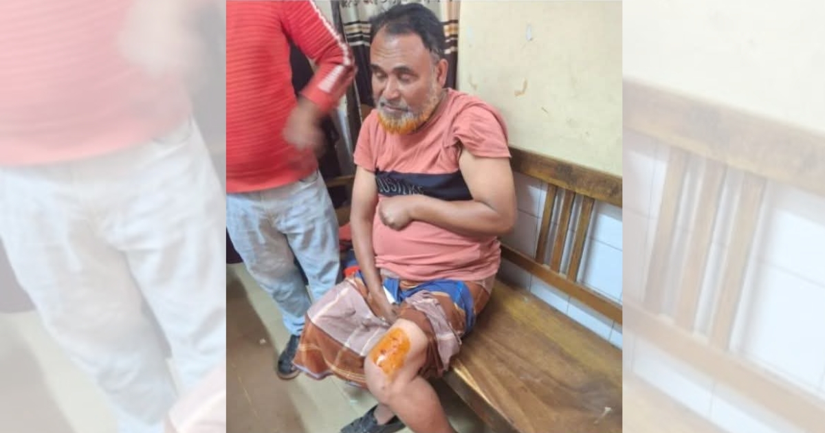 ব্রাহ্মণবাড়িয়ায় কুকুরের কামড়ে শিক্ষিকাসহ আহত ৫