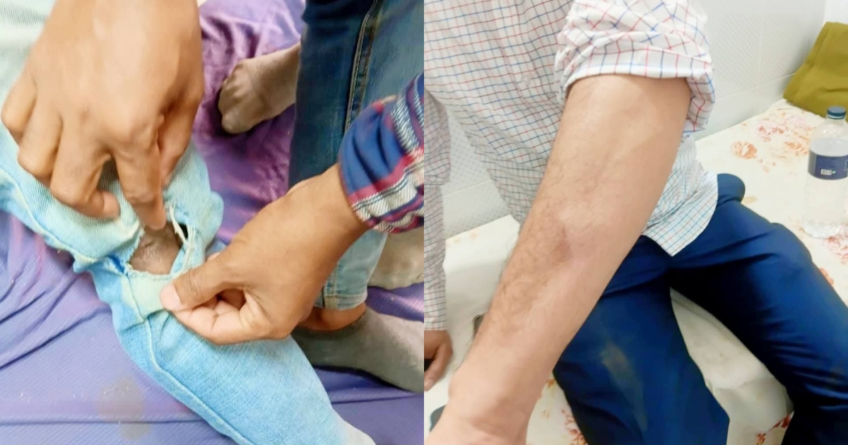 মুন্সিগঞ্জে ফুটবল ও ধানের শীষের সমর্থকদের মধ্যে সংঘর্ষ