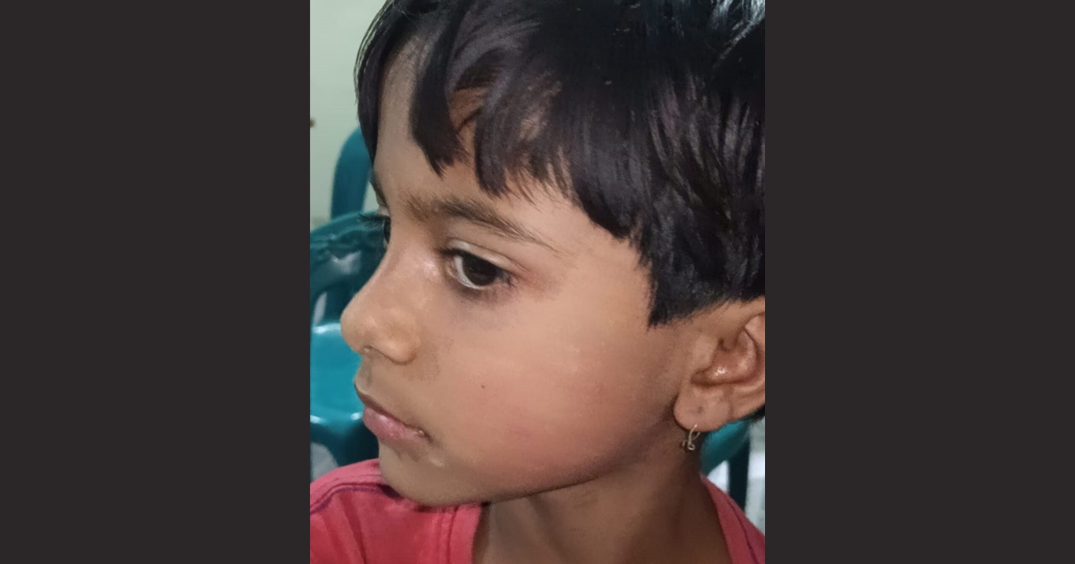 তালায় শিক্ষকের মারধরে রক্তাক্ত ২য় শ্রেণির ছাত্রী