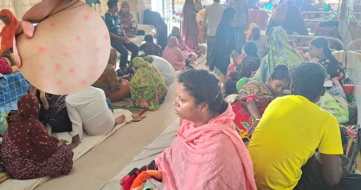 দেশে হামের সংক্রমণ পরিস্থিতি ভয়াবহ রূপ নিচ্ছে, গত ২৪ ঘণ্টায় হামে আরও ৩ মৃত্যু, আক্রান্ত ৯৪৭