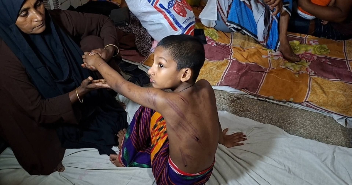 সামান্য কারণে বেত্রাঘাত, মাদরাসায় শিশুর শরীরজুড়ে ক্ষতচিহ্ন